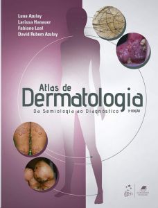Atlas de Dermatologia 3° Edição