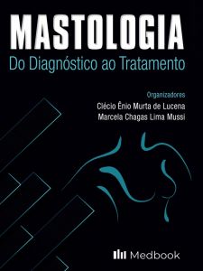 Mastologia do Diagnóstico ao Tratamento